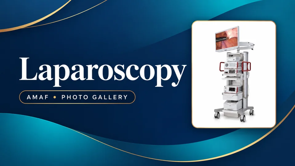 Laparoscopy — cover featuring the original photograph